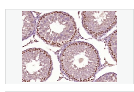 Anti-HOXA10  antibody-HOXA10抗体