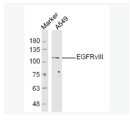 Anti-EGFRvIII antibody-B-表皮生长因子受体III型突变体抗体