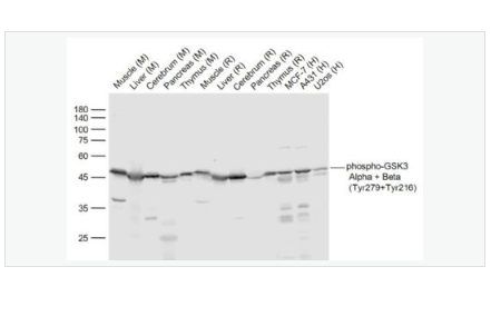 Anti-phospho-GSK3 Alpha + Beta antibody-磷酸化糖原合酶激酶3α/β抗体