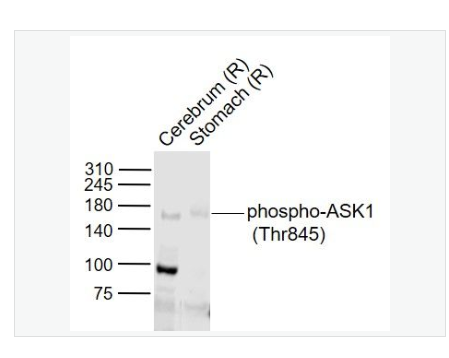 Anti-phospho-ASK1  antibody-磷酸化细胞凋亡信号调节激酶1抗体