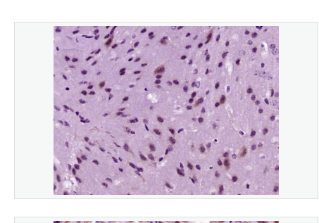 Anti-ACACA  antibody-乙酰辅酶A羧化酶抗体