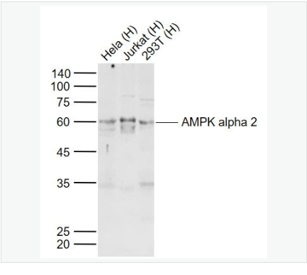 Anti-AMPK alpha 2  antibody-腺苷单磷酸活化蛋白激酶α2抗体