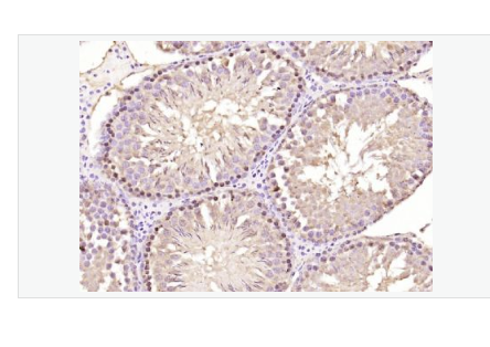 Anti-phospho-HDAC7 antibody-磷酸化组蛋白去乙酰化酶7抗体