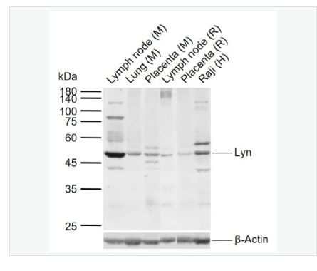Anti-Lyn  antibody-膜相关蛋白酪氨酸激酶Lyn抗体