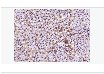 Anti-Phospho-SIRT1  antibody-磷酸化沉默调节蛋白1抗体
