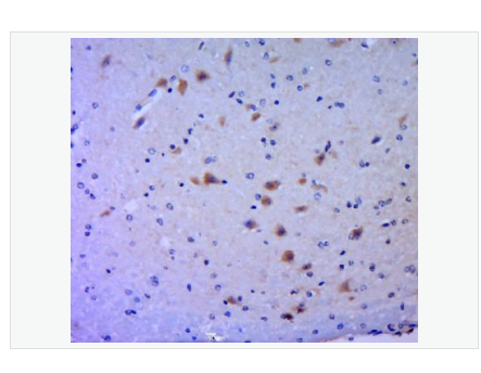Anti-Phospho-MLK3   antibody-磷酸化丝氨酸/苏氨酸蛋白激酶MLK3抗体