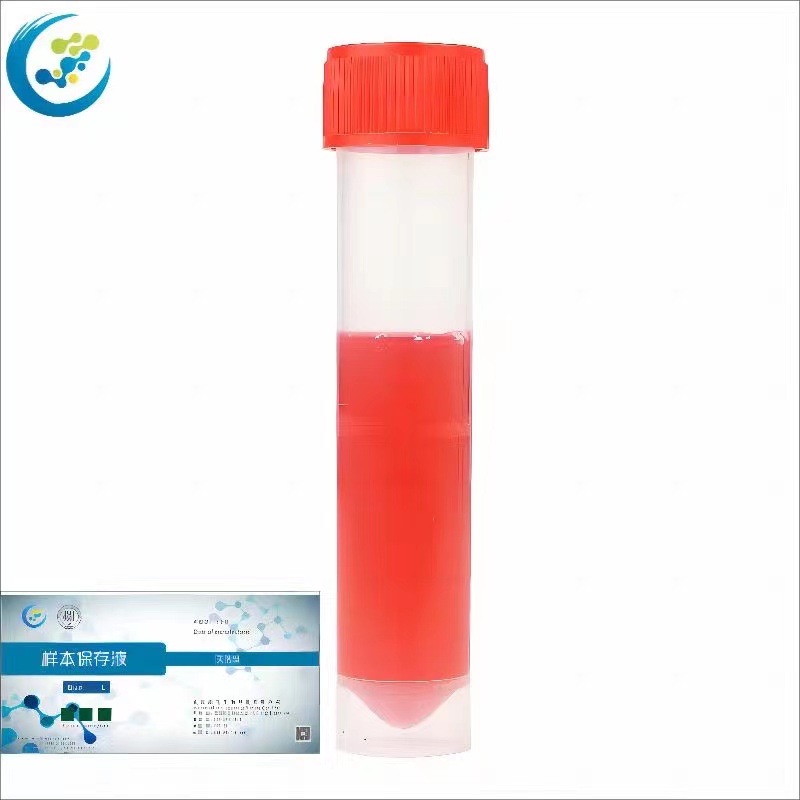 样本保存液（灭活型）