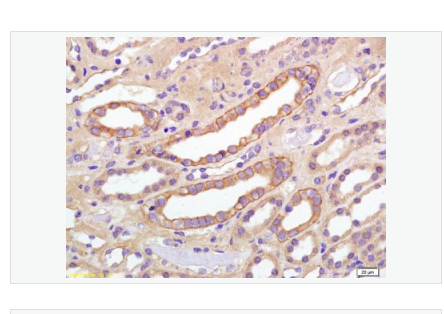 Anti-phospho-IGF1R antibody-磷酸化胰岛素样生长因子1受体抗体
