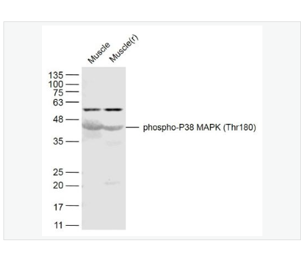 Anti-phospho-P38 MAPK antibody-磷酸化p38MAPK抗体