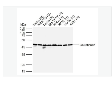 Anti-Calreticulin antibody-钙网蛋白抗体