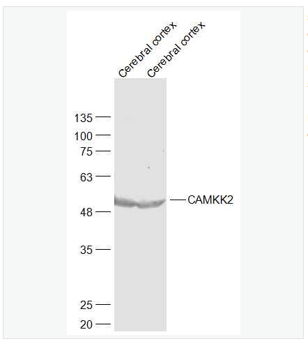 Anti-CAMKK2 antibody-钙调蛋白激酶激酶β抗体