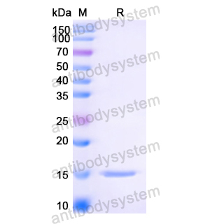 Anti-HIV1 Surface protein gp120 Nanobody (SAA0912)