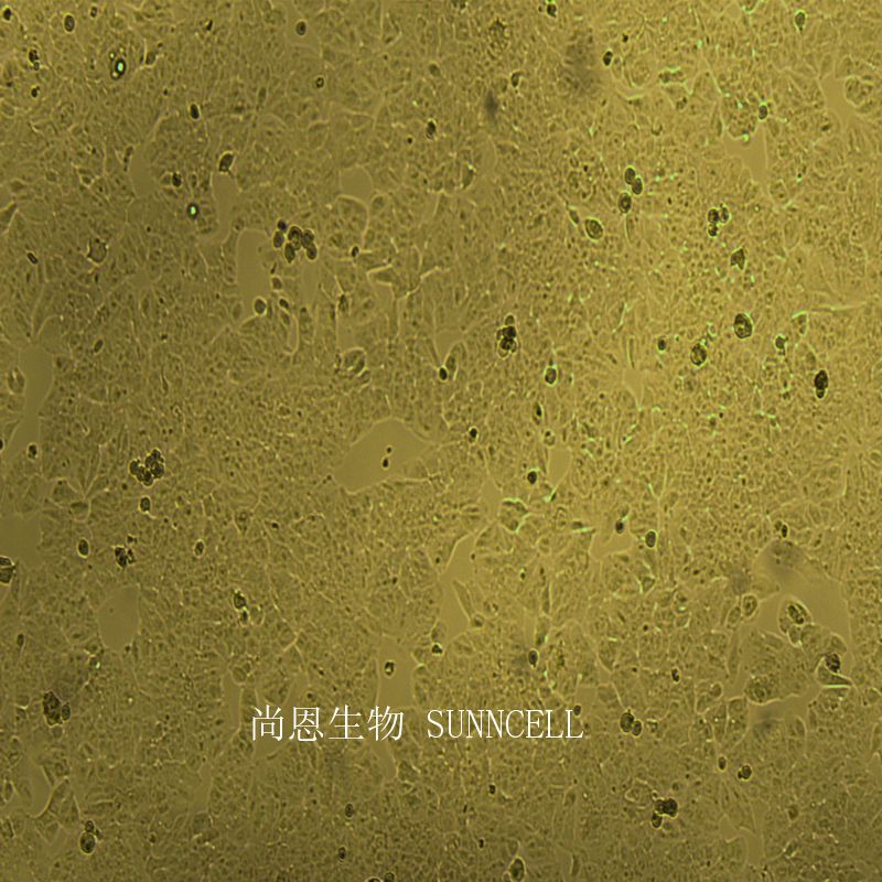 人低转移肝癌细胞