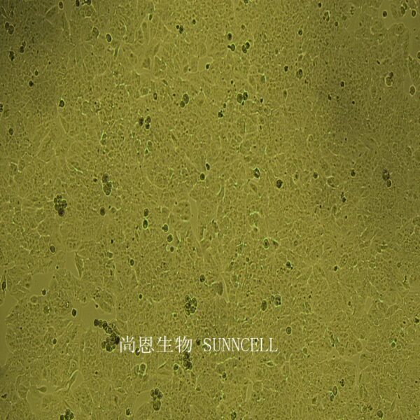 人低转移肝癌细胞