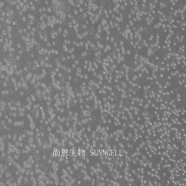 小鼠淋巴样瘤细胞