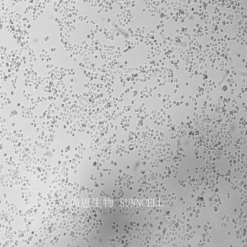 人急性早幼粒白血病细胞