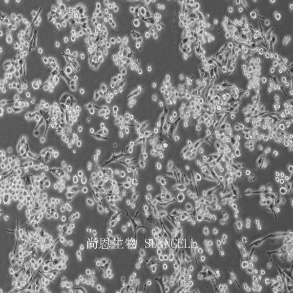 小鼠脑神经胶质母细胞