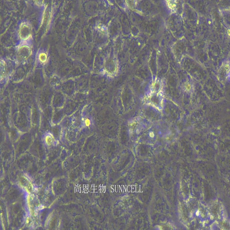 人输尿管上皮永生化细胞