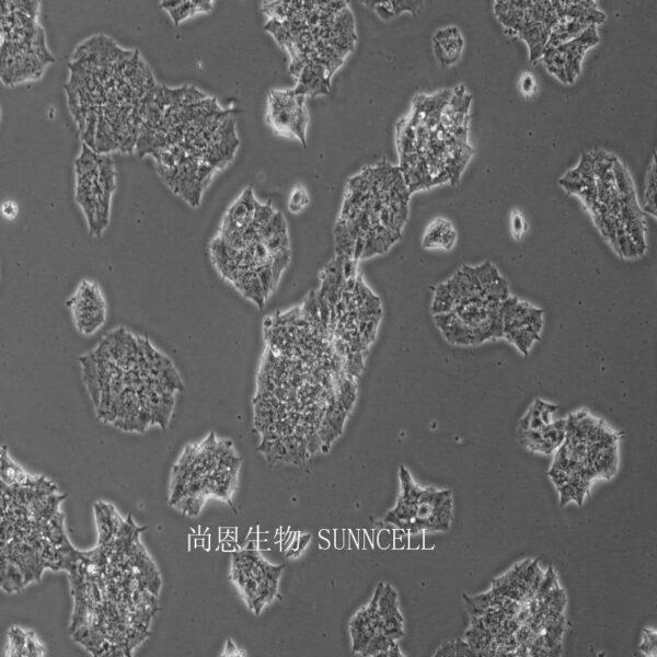 小鼠垂体瘤细胞