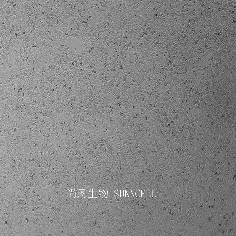 小鼠逆转录病毒包装株