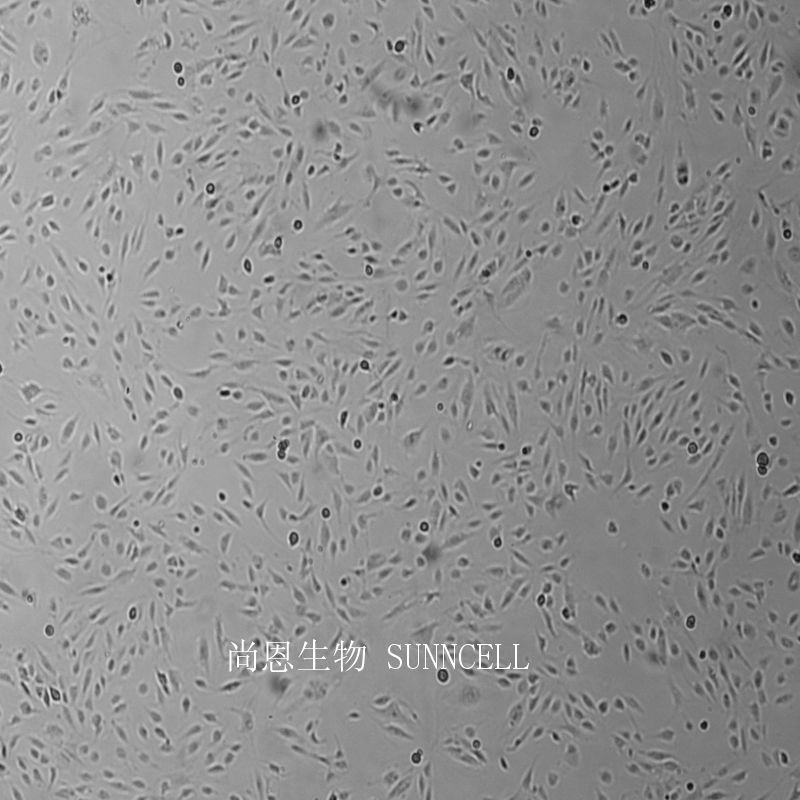 人微血管内皮细胞