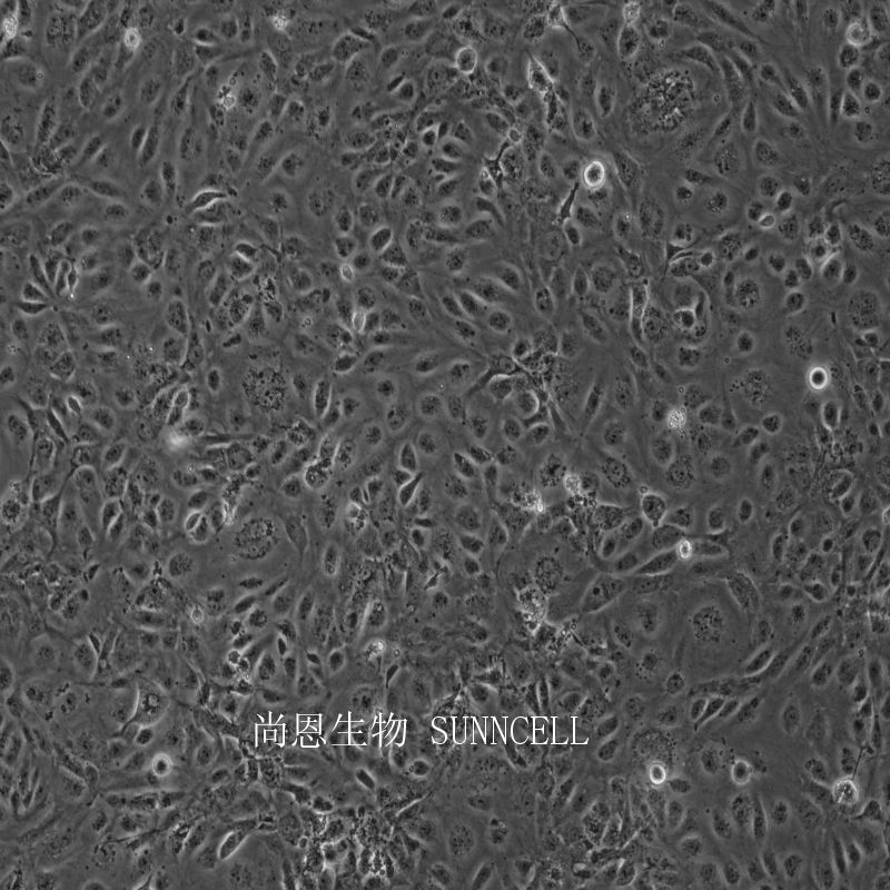 人微血管内皮细胞