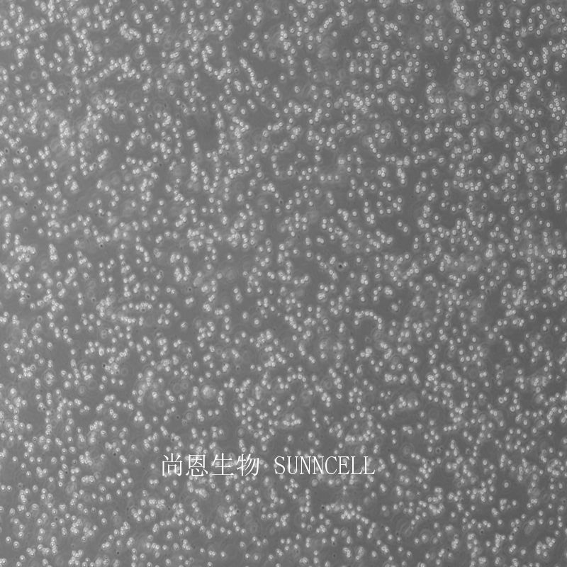 JM人T淋巴细胞白血病细胞