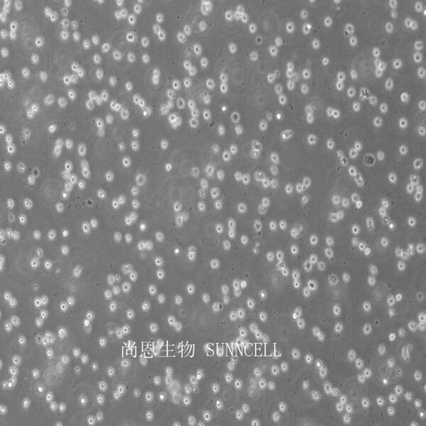 JM人T淋巴细胞白血病细胞