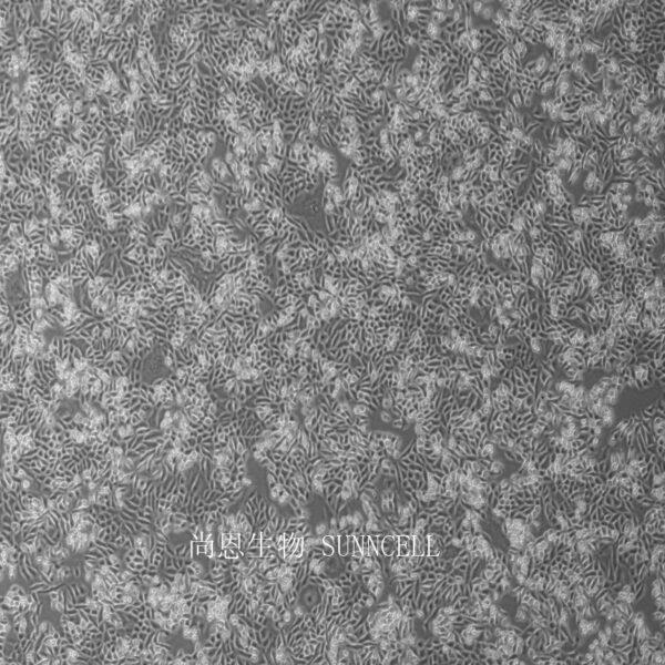 小鼠卵巢上皮癌细胞