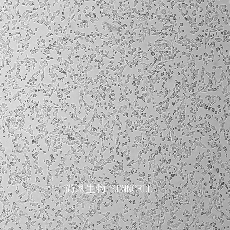 小鼠肾上腺皮质瘤细胞