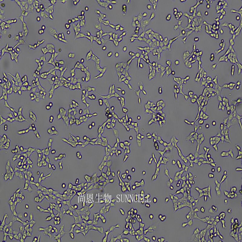 人高转移肺癌细胞