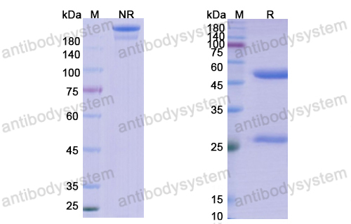 Research Grade Lanadelumab  (DHC04301)
