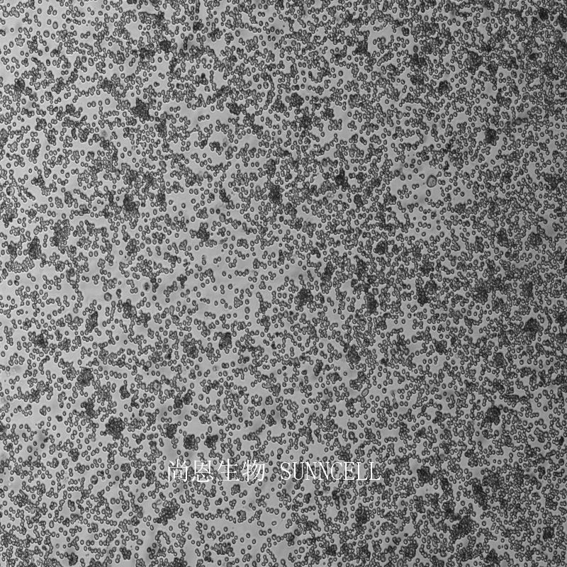 人急性早幼粒白血病细胞