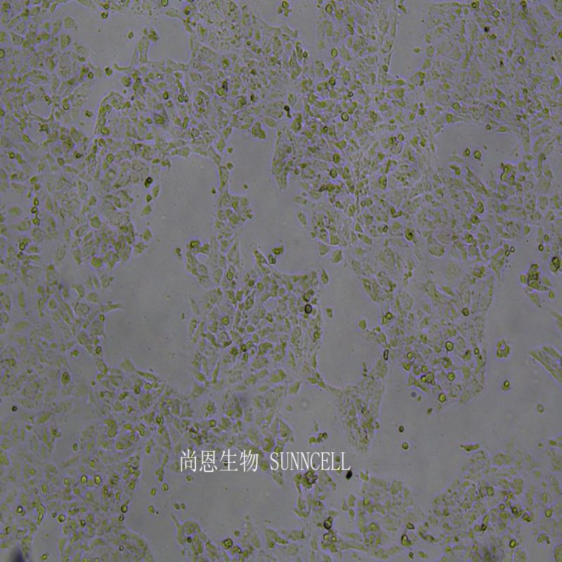 人输尿管上皮永生化细胞