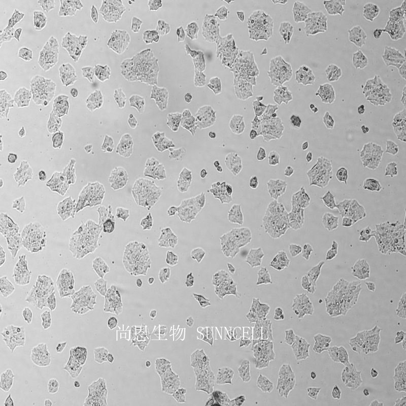 小鼠垂体瘤细胞
