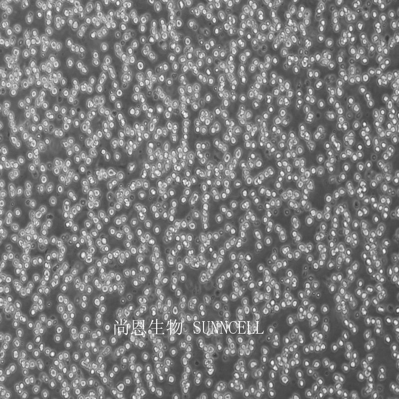 中国仓鼠X小鼠B淋巴细胞杂交瘤