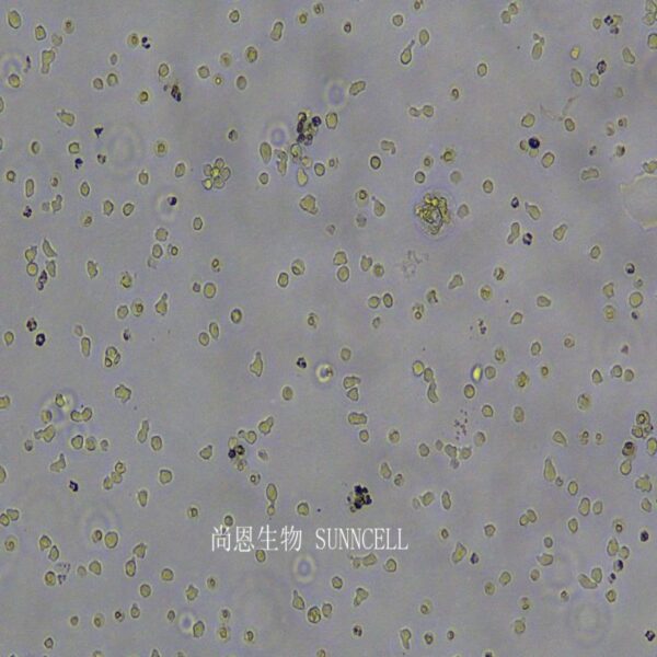 TOLEDO人弥漫大B细胞淋巴瘤细胞