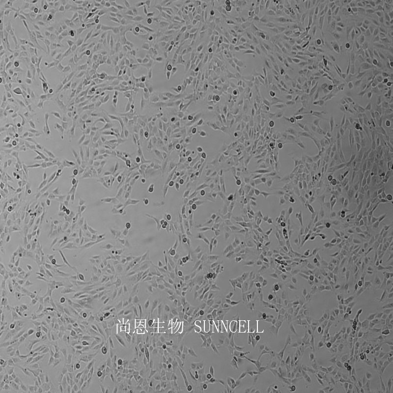 人正常前列腺基质永生化细胞