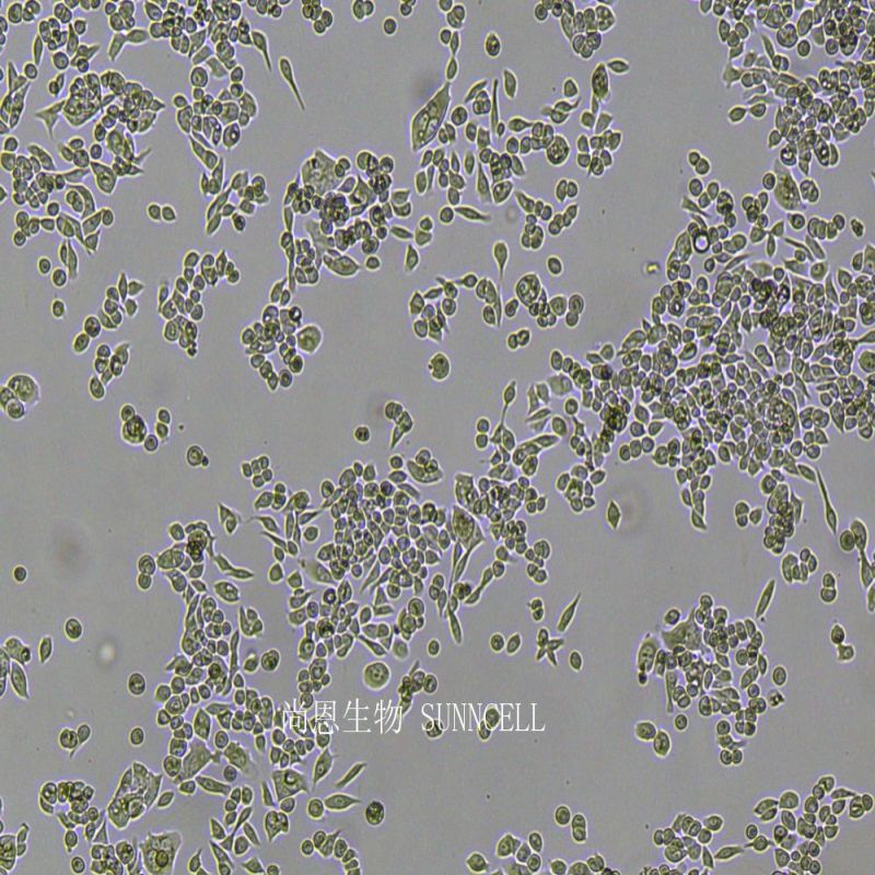 人低分化胃癌细胞