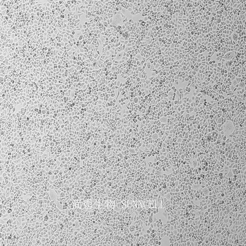 人小细胞肺癌细胞