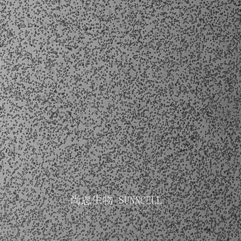 人急性骨髓白血病细胞