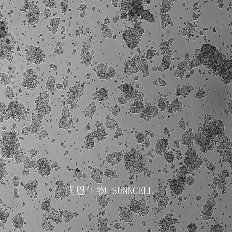 ZR-75-1人乳腺癌细胞