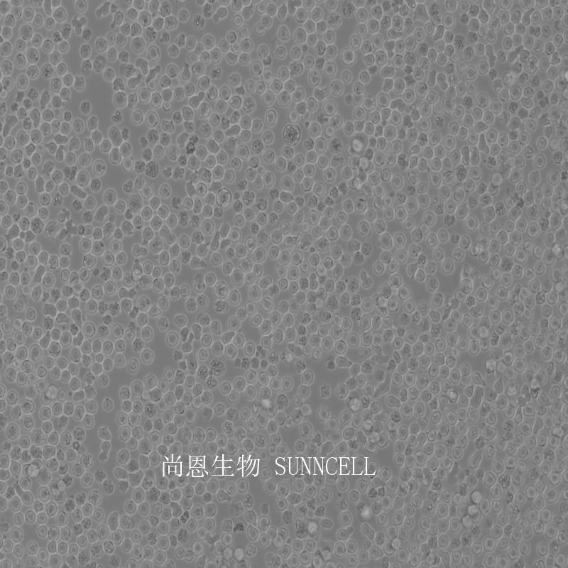 小鼠髓性白血病淋巴细胞/小鼠白血病G-CSF依赖性细胞