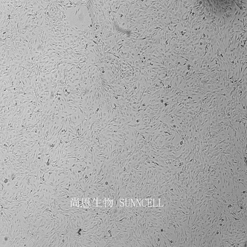 大鼠脑微血管内皮细胞永生化