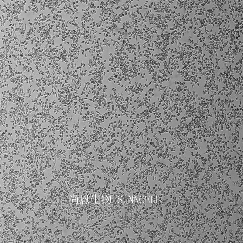 大鼠嗜碱性细胞白血病细胞