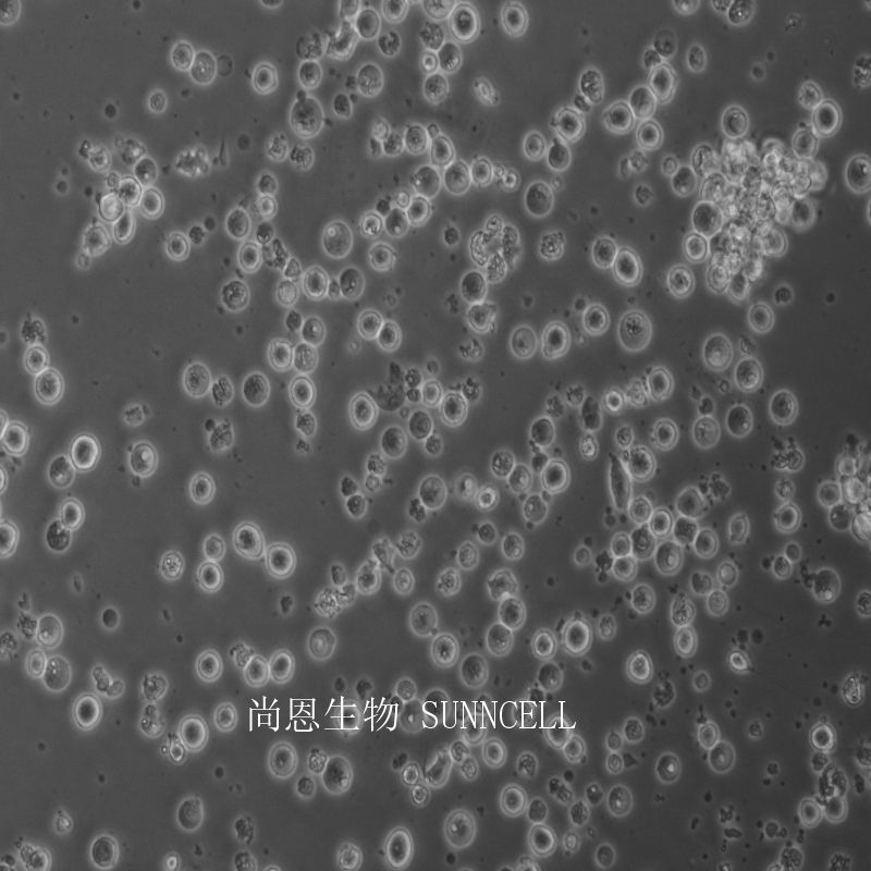 人外周血嗜碱性白血病细胞