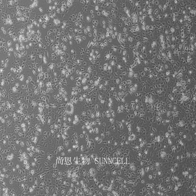 人食管鳞癌细胞