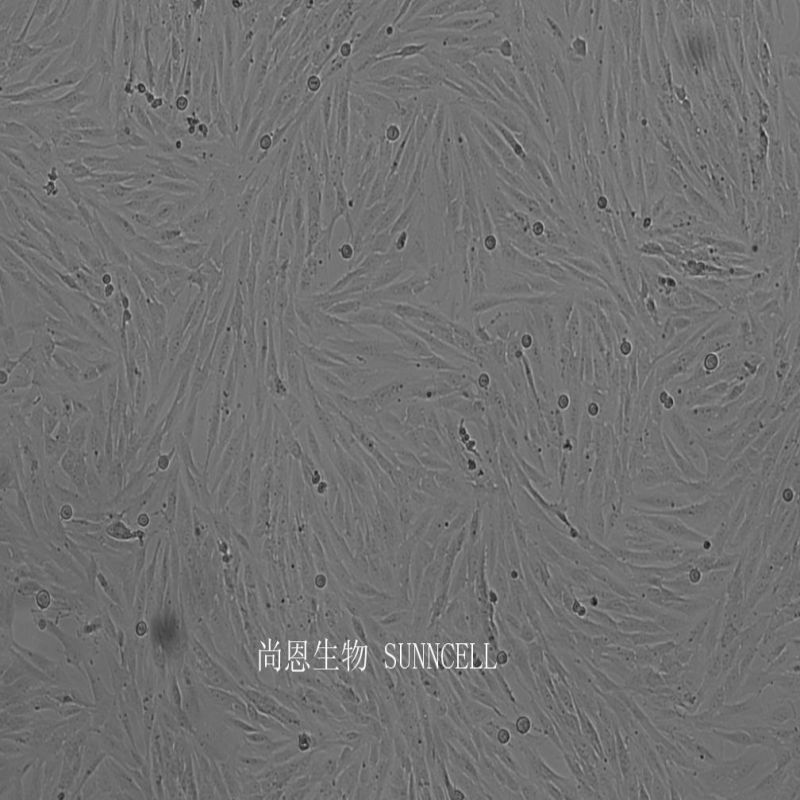 SF126人胶质母细胞瘤细胞