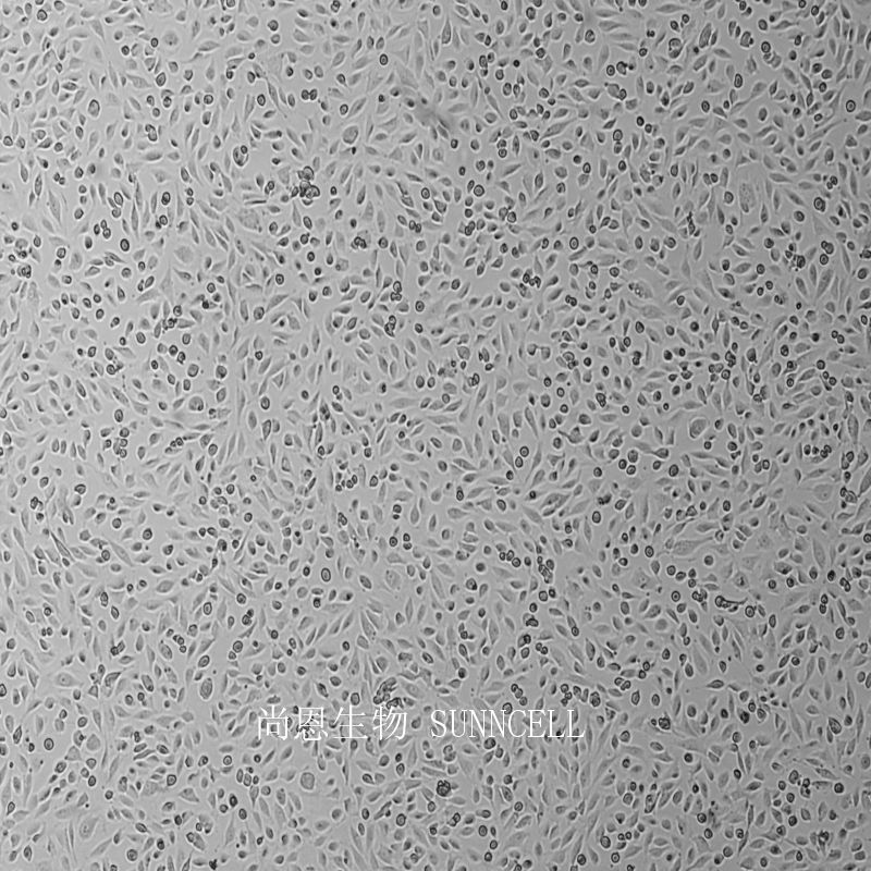 人脐静脉细胞融合细胞