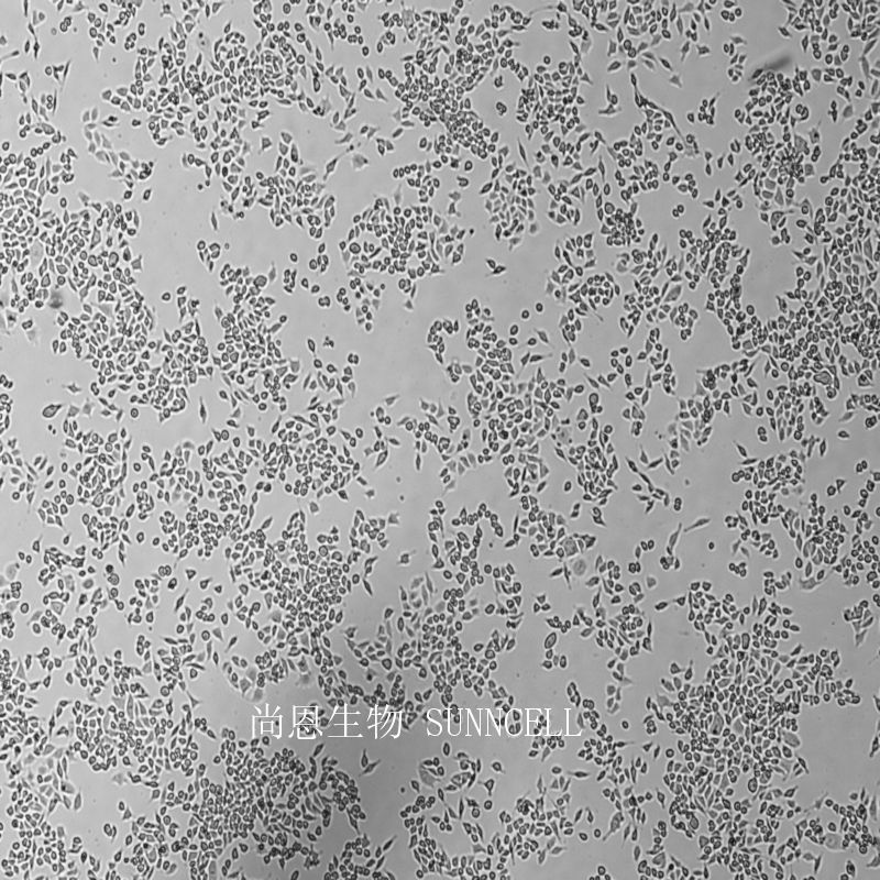 人结肠癌转基因细胞